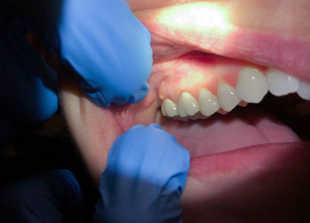 Best Walk-In Emergency Dental Services in Glencoe, MN